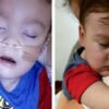 Alfie Evans se aferra a la vida