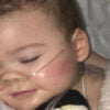 Muere Alfie Evans